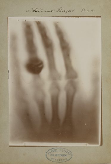 Teylers Museum vindt oudste röntgenfoto’s ter wereld
